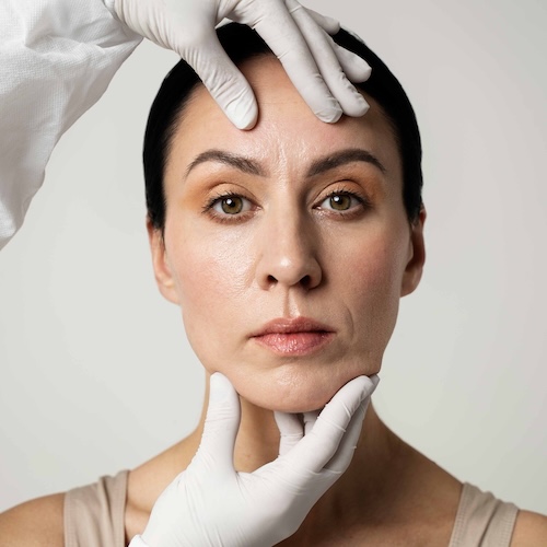 Morpheus 8 Treatment